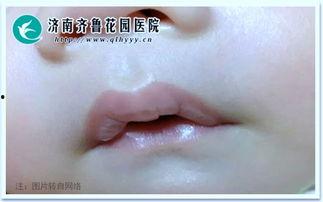 宝宝吃瓜之后嘴唇发黑,宝宝吃瓜后嘴唇发黑之谜揭秘